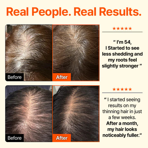 Korea's No.1 : HAIR GROW:TURN Ampoule